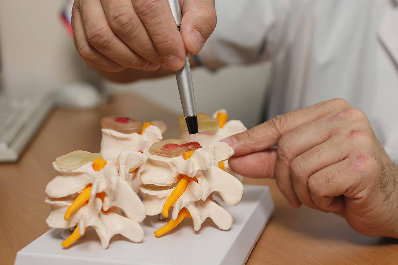 Как появляется грыжа диска2